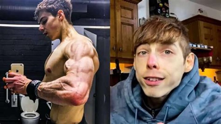 How Did Scott Murray Die? What Was His Cause Of Death?