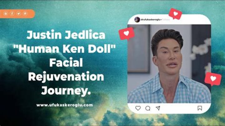 Justin Jedlica Husband Plastic Surgery : Meet Human Ken Doll Partner Jayson McNaughton - SarkariResult